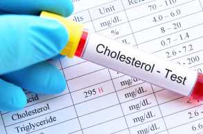 Jaga Kadar Kolesterol Tetap Aman, Ini 4 Cara yang Perlu Dilakukan
