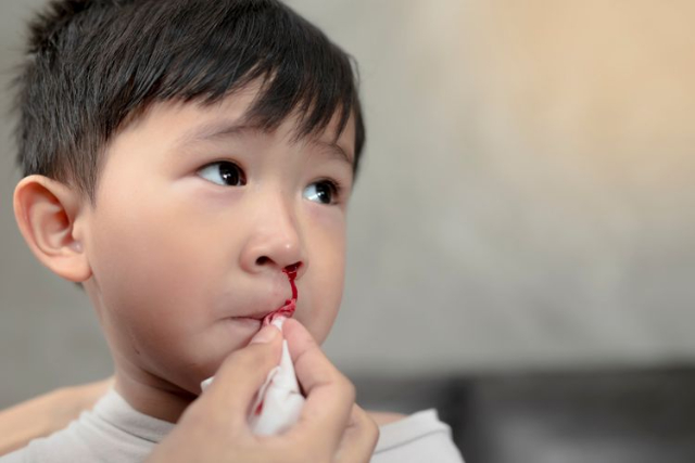 Kenali Penyebab Mimisan pada Anak dan Tips Mengatasinya
